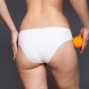 Reducción de celulitis